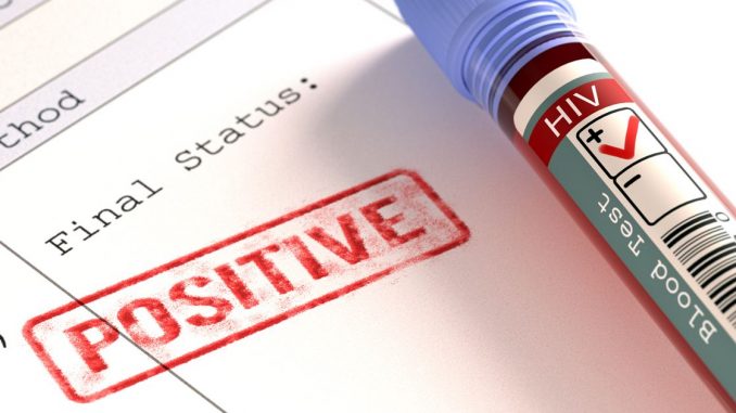 retaining HIV transgender patients